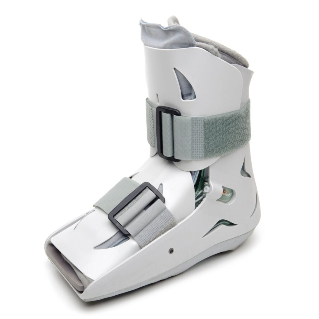 Foot and Ankle Cast
